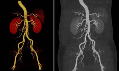济南南郊医院已成功开展冠状动脉CT强能力，促提升| 冠状动脉