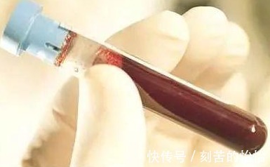 血脂|各年龄血压、血糖、血脂、血尿酸对照表,果断收藏,以备不时之用