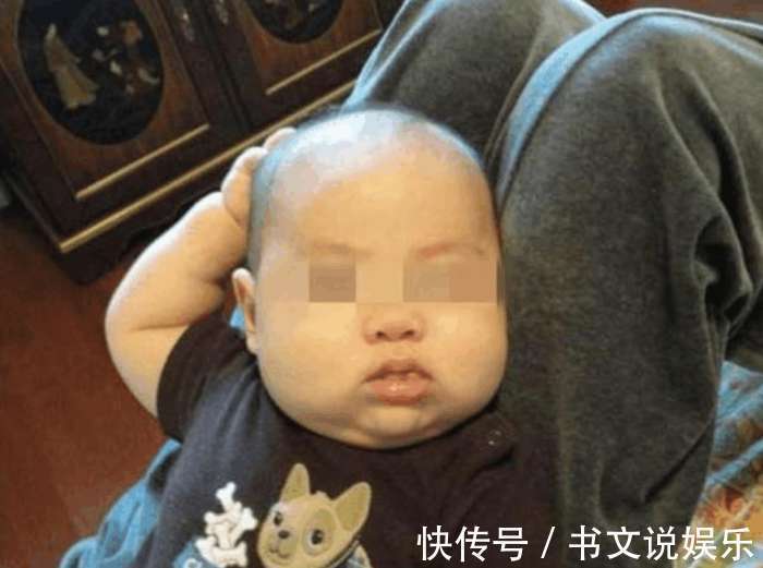 检查|妈妈发现一岁的孩子总是喜欢摸头,去医院检查后,让她庆幸不已