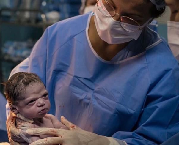 出生|巴西女娃出生后“摆臭脸”火遍全网,网友调侃又有新表情包了