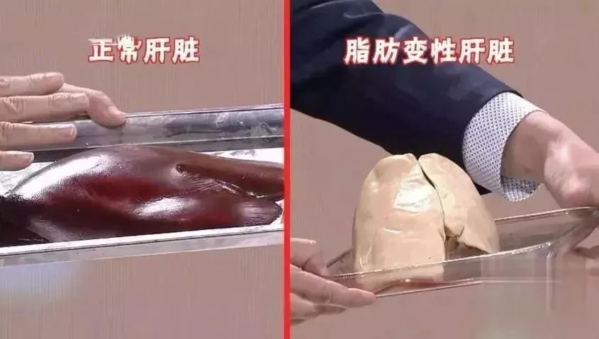 養肝|長期喝酒、熬夜太傷肝！這種藥草，養肝降血脂