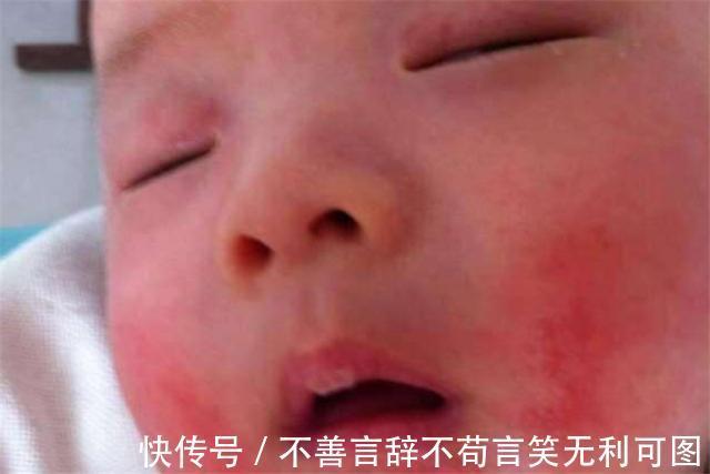 小雨|妈妈擅自为2岁宝宝驱蚊,却致其呼吸停止,及时抢救才脱离危险