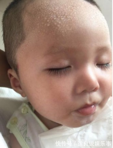 宝妈|孩子2个部位出汗多,是脾胃差,家长牢记“3不要”,脾胃渐渐好