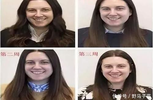 皮炎|你有什么让皮肤变好的诀窍?亲历:半个月没洗脸,皮肤变光滑了