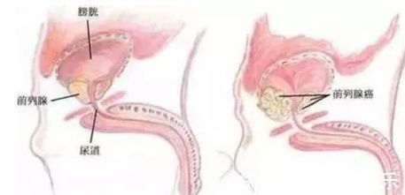 抗癌|8种癌都怕这种菜!但99%的人都吃错了,配上它,营养翻倍~