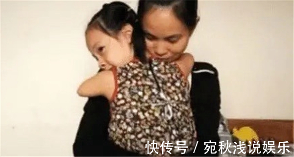 先天|执迷不悟,孕检发现胎儿“没手没脚”,宝妈:我会爱他,执意妊娠