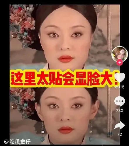 讓耳朵支楞起來大可不必
