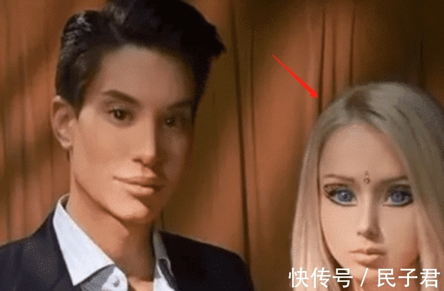 翅膀 男子花200万植入翅膀,接受120次整容手术,现与“芭比娃娃”相爱