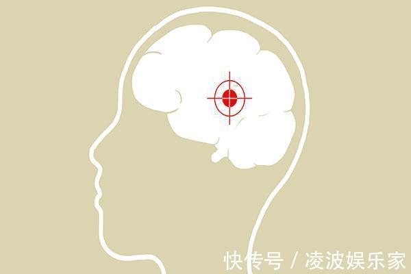 脑梗|脑梗来临，头部先知道！头部出现什么变化，要警惕脑梗