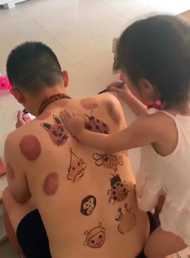 妞妞|爸爸拔完火罐回到家,下一秒女儿的这一举动,网友直呼:太有才