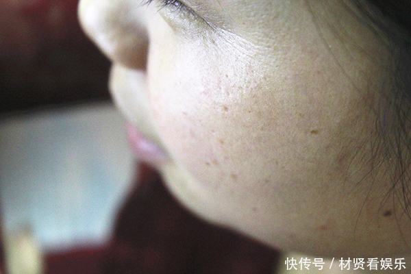 女子为了抗衰老,每晚睡前服用维生素E,她的身体最后怎么样了