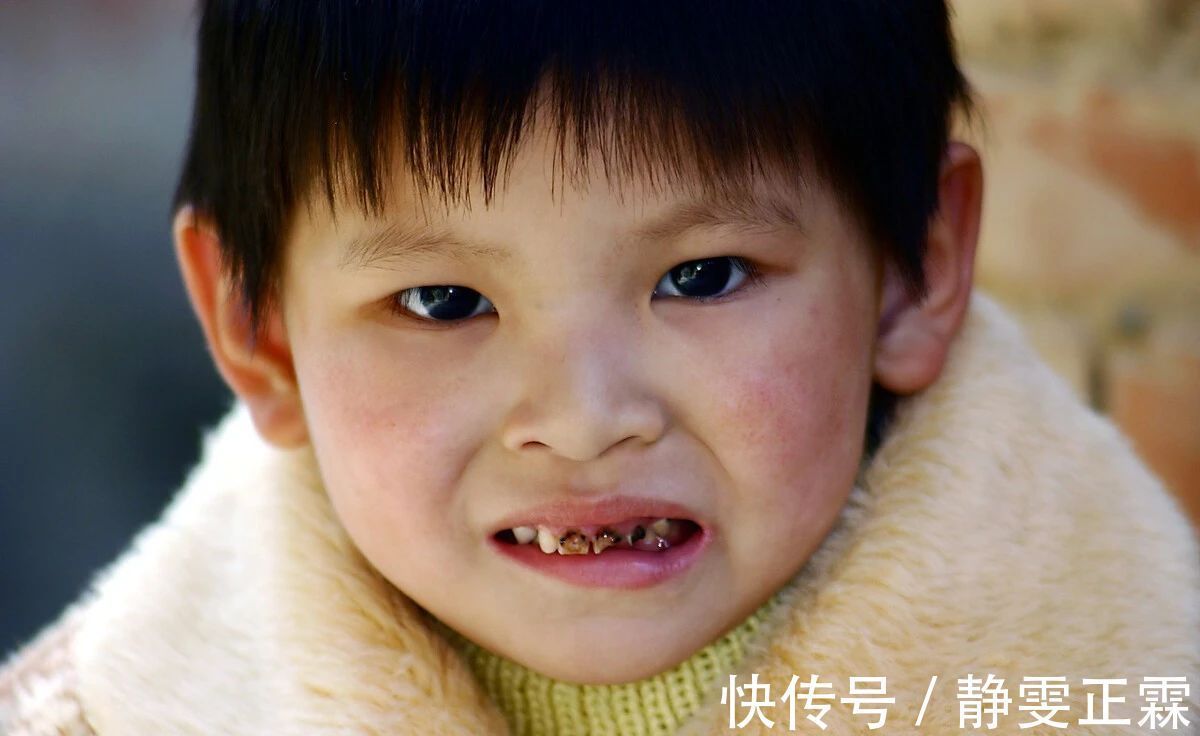 小小年纪|孩子小小年纪就蛀牙?宝宝牙齿问题并不简单!