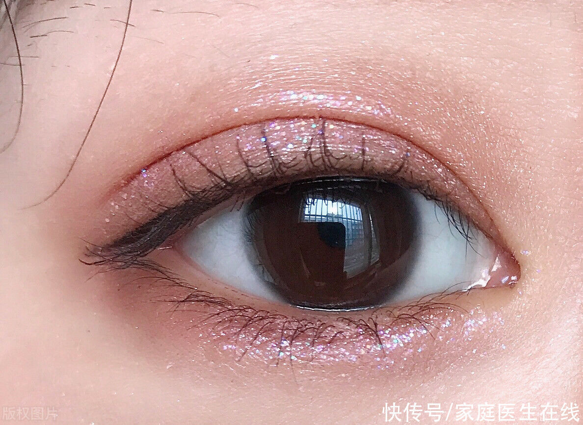 双眼皮手术后疤痕增生是怎么了?做好3件事,可帮你预防