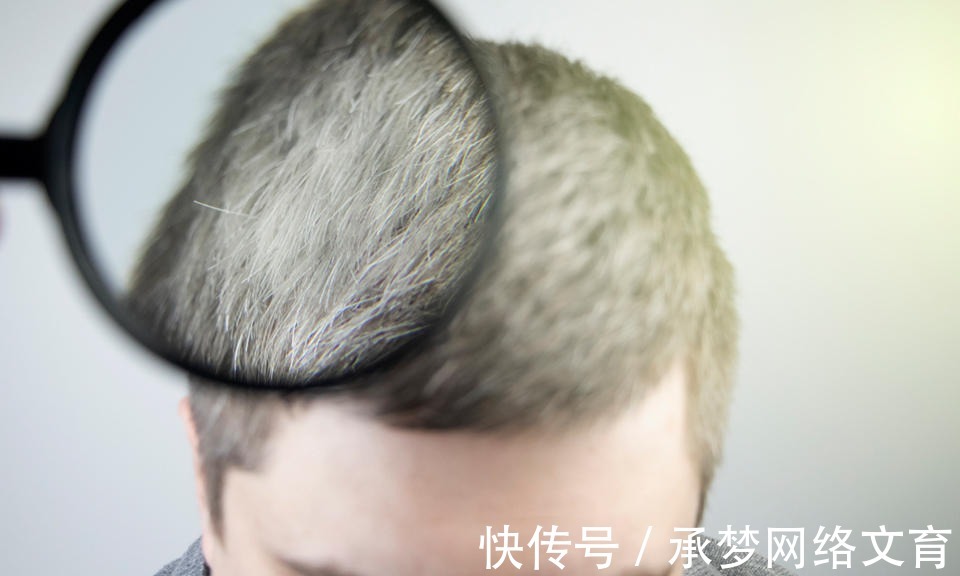 粗壮|头发太纤细,三个方法让头发变粗壮!