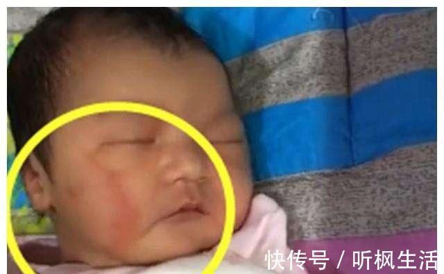 婆婆|宝宝出生有“产钳印”,婆婆责儿媳没本事,心凉啊