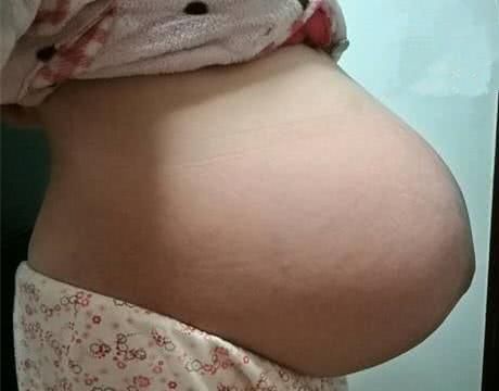 為啥懷孕后孕媽肚型都不同?醫生:跟胎兒性別沒關係,主要看3點