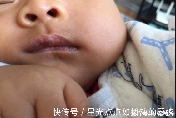 脾胃|“脾胃虚”的宝宝,身上这2个部位经常出汗,父母早了解娃早受益