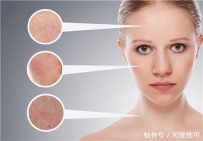 防晒|只有化妆才需要卸妆?告诉你什么才是护肤第一步