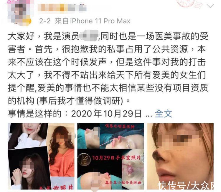 手术|吸脂减肥又现惨剧,被美“绑架”有风险