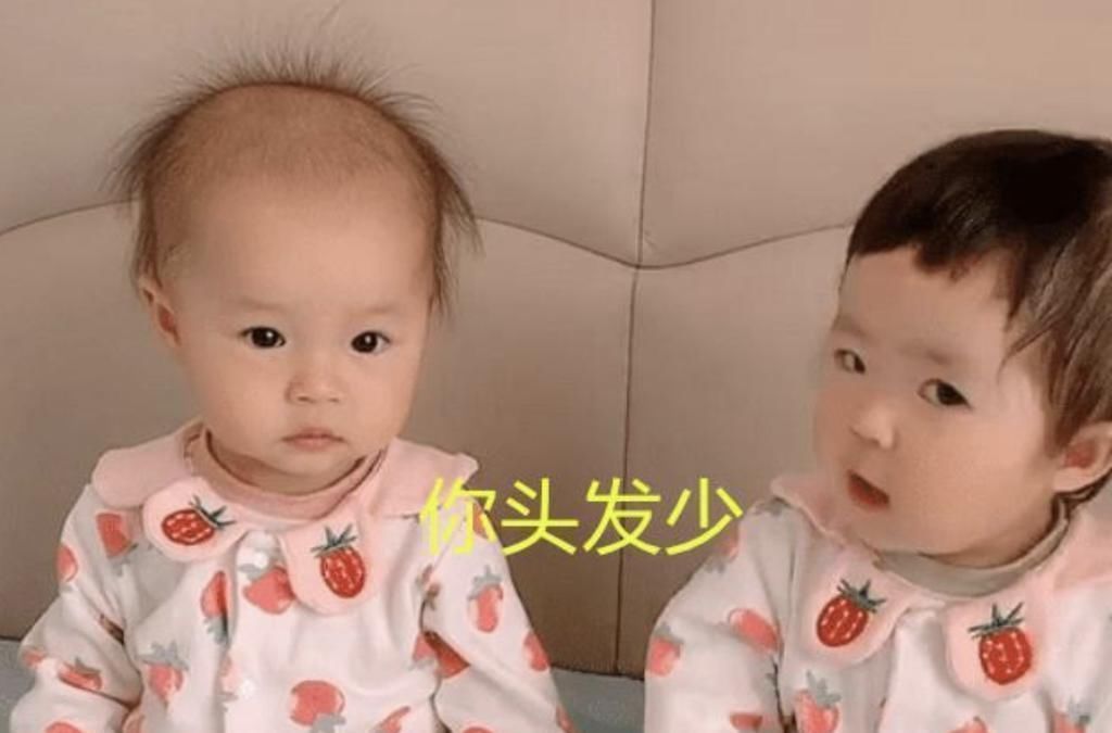 指甲油|最好认的双胞胎走红,发量一个随妈一个随爸,网友:妈妈真偏心