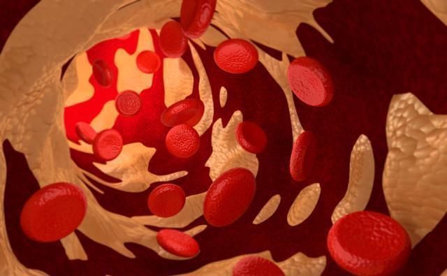 肝脏|指甲上有“竖纹”,可能是这4种情况,别忽略身体的“求救信号”