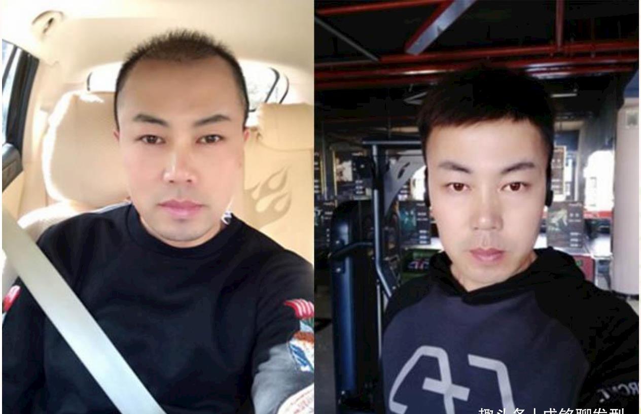 头发|35岁头发基本全部怎么办?试试不染发的的两种发型,帅气又减龄