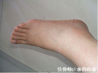 红酒|血管堵塞时，脚上或许会发出信号，若都没有，说明血栓离你还很远