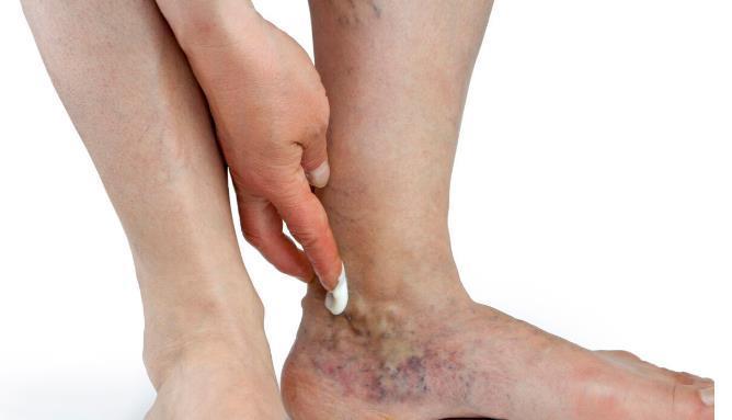 天天离不开高跟鞋?女性长期穿高跟鞋的这6大危害,不可不知