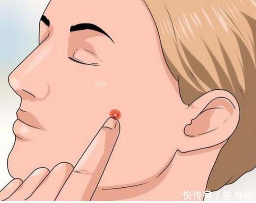 长痘不想留痘印，这4个让你留痘印的“罪魁祸首”早点除掉！