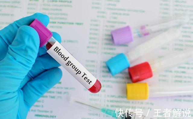 医生|血压正常,却经常头晕?医生:6种疾病平时多留意