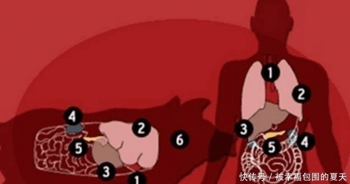 患有|女子死于中风,将器官捐献给5人,结果先后四人不幸中招