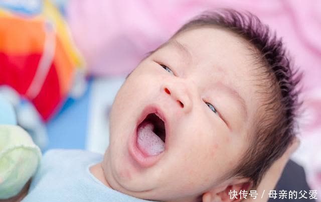 宝宝出生后穿连体衣还是穿分体衣？这件小事有大讲究，要弄清楚