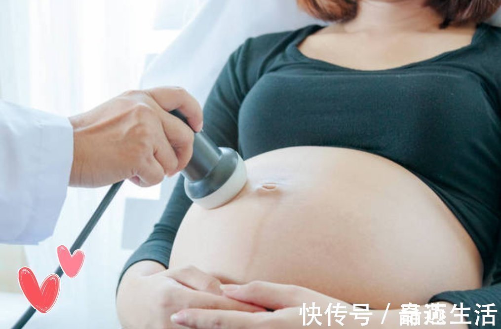 胎心|怀孕后,准妈妈何时去做胎心监护?要做几次?都有哪些注意事项?