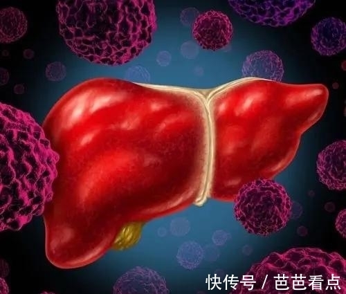 蜘蛛痣|“肝病之父”吴孟超，总结60年养肝经验：做好3件事，肝脏自通透