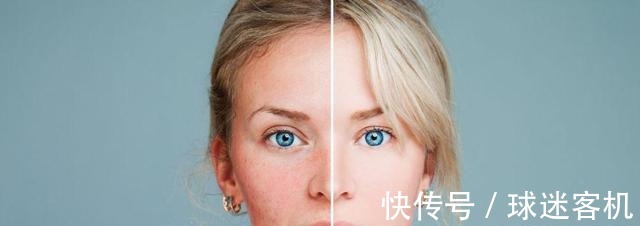 大拉皮 王小民教授做小拉皮的人逐渐增多,网上传言却没有效果!