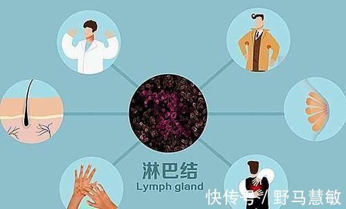 癌症|淋巴结肿大不是淋巴癌的唯一症状,得了淋巴癌,还会有哪些异常