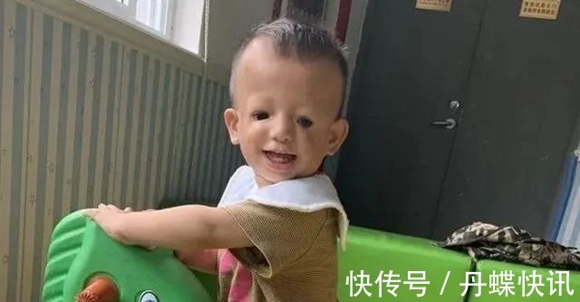 二胎|“鸟脸”妈妈执意生二胎,孩子不幸被遗传,一时的冲动毁孩子一生