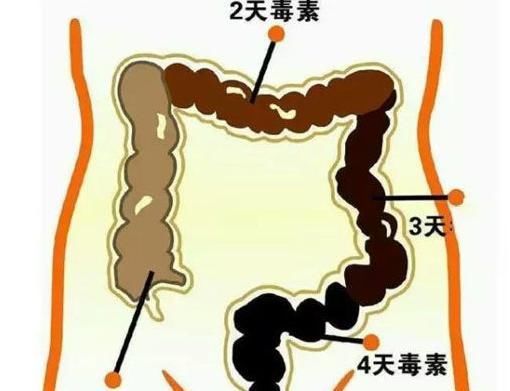 常便秘的人，谨记2句话，常吃2种菜，减少毒素，不发胖