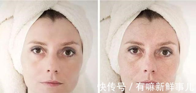 自我修护 如何提升皮肤的自我修护力避开这些护肤误区,皮肤才会越来越好!