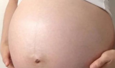 精华乳|生个孩子“肚皮开花”，孕期做好掌握这3点，妊娠纹离你远远的