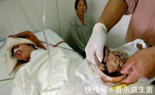 麻醉针|女子身体疼痛难忍，去医院拍片检查，手术取出后，丈夫大怒