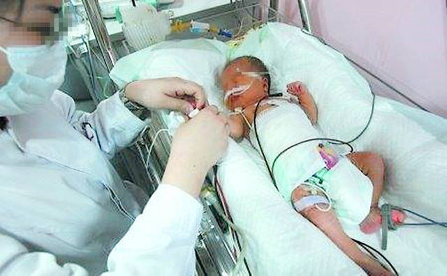 王女士|新生儿患上败血症,只因妈妈这个小动作,网友怎么狠心下得了手