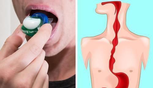 伤害|生活中可能会对孩子造成潜在危险和伤害的8个物品