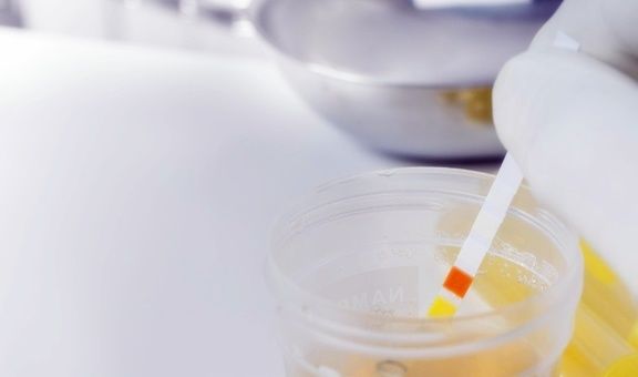 血糖|糖尿病患者的尿又黄又骚是什么原因?你真的知道吗?看专家的理解