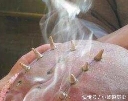 和尚|古代和尚头上为什么要烧戒疤 这东西有什么讲究吗