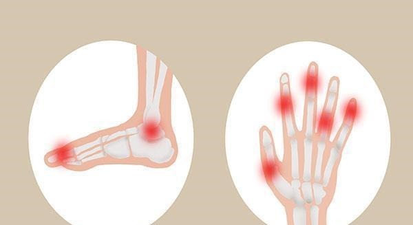 患者|蔬菜中也会有“嘌呤大户”？以下几种蔬菜，高尿酸患者尽量少吃