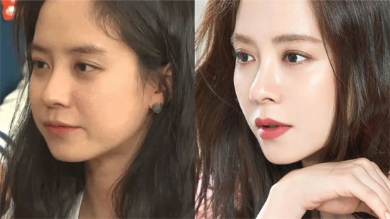 原液|国产精华液排行榜 不仅价格实惠 效果更是不输很多大牌