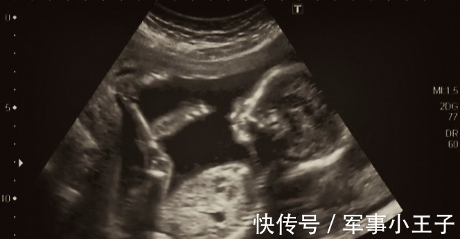 胎儿|孕期肚子里的胎儿健不健康?只要看这2个指标就够了!