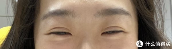 13年前做的双眼皮到现在还好吗？双眼皮带给我的变化