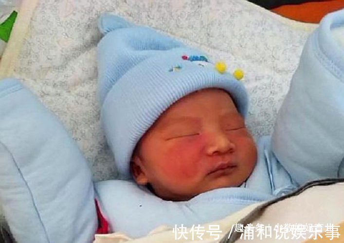 产科医生|胎记是怎么来的?妇科医生:除了遗传,孕期尽量避开这3种行为